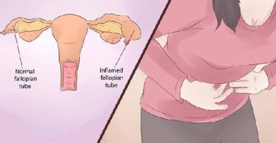 Blocked Fallopian Tube &ndash; Can You Still Become Pregnant?