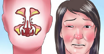THIS Is How You Can Clear Your Stuffy Nose For Good With This Genius Trick In Only 2 Minutes