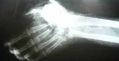 Here Are 23 Facts About Left-Handed People That You Didn't Know About. The Last One Surprised Me.