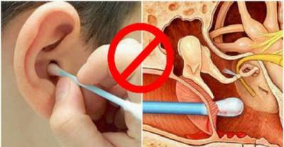 After Seeing This You&rsquo;ll Never Use Cotton Swabs For Cleaning Your Ears Again