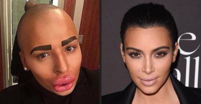 12 People Who Abused Plastic Surgery To Look Like Celebrities