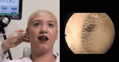 People Getting Their Ears Cleaned For The First Time Is Grossly Satisfying