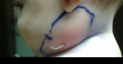 Parents Noticed Something Strange Coming Out Of Their Baby Girl&rsquo;s Neck. What Came Out? OMG!