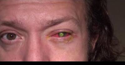 This Guy Went Blind Because He Made A Simple Mistake Many People Make Every Night