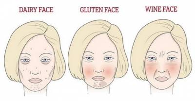This Is Exactly What Wine, Gluten And Sugar Does To Your Face