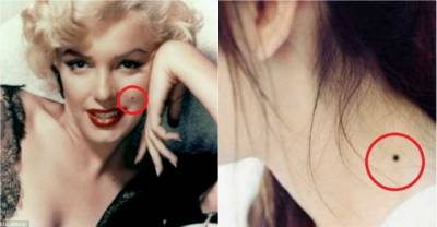 See What Moles And Their Location Say About Your Personality