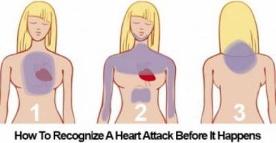 How To Survive A Heart Attack When You&rsquo;re Alone
