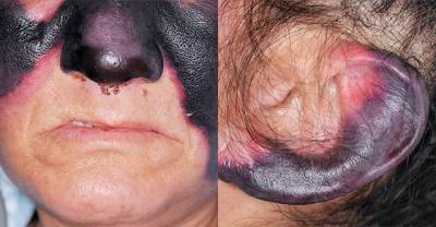 Stop Everything You Are Doing And Watch These Terrible Cocaine Effects