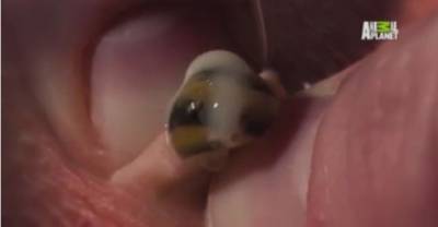 This Mother Found Something Shocking Popping Out Of Her Son's Wound!