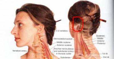 These Food Items Can Cause Headache &ndash; Stop Eating Them Frequently