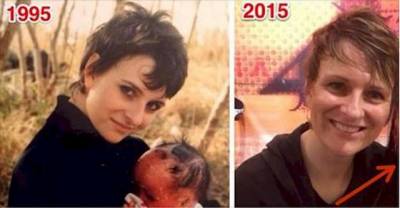 Doctors Hid This Baby So Nobody Could See THIS Face. 22 Years Later, She Shows It All.