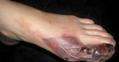 Warning: Be Careful When Getting A Pedicure. This Could Happen To You!