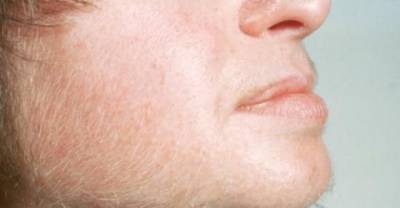 7 Shocking Things Your Body Hair Reveal About You Health!
