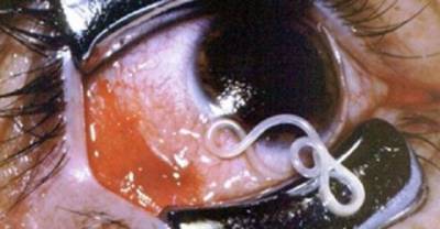 10 People Who Had Things Living Inside Them