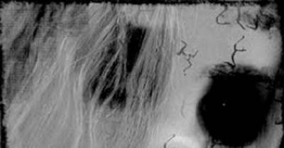 9 Extremely Bizarre Phobias!