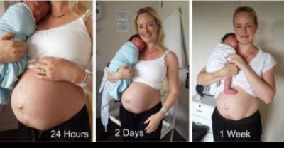 This Woman Takes Off Her Shirt To Display Something Truly Inspiring.