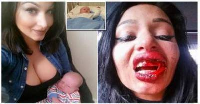 Pregnant Model Is Assaulted Brutally While Holding Her New Born