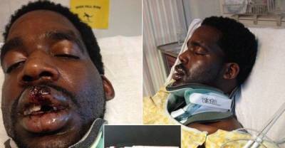 Man&rsquo;s E-Cigarette Lands Him In The Hospital After Troubling Malfunction