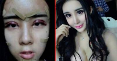 15 Year Old Chinese Girl Undergoes Extreme Plastic Surgery Causing Creepy Fans To Claim She Is 'Too Beautiful To Look At'