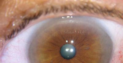 This Is What Your Iris Says About Your Health
