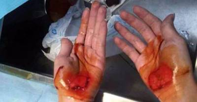 Children Forced To Walk On Their Hands Until They Bled At School In China Who Tried To Skip Class