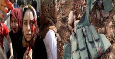 Cruel Reality Of War Shown By Dreadful Pictures From Syrian Frontline