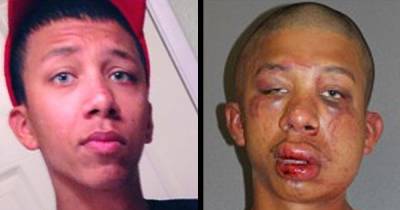 Father Breaks Almost Every Bone In Man&rsquo;s Face After Discovering His Daughter&rsquo;s Babysitters Were Drunk