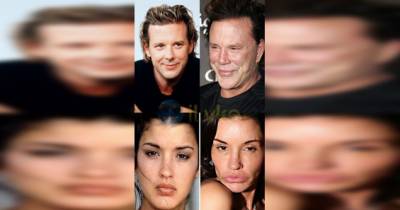 These Celebs Destroyed Their Looks With Plastic Surgery