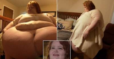 Woman Weighing 650 lbs Is Blaming Her Parents For Her Condition