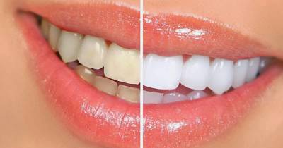 10 Super Easy Tips To Turn Your Teeth Marble White