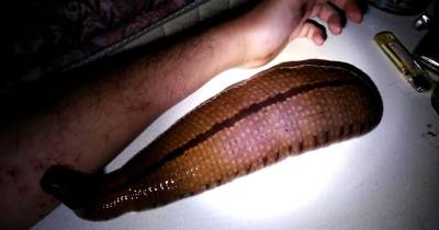 Wtf! Man Keeps Giant Leech For A Pet, Lets It Feed On His Arm