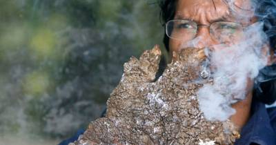 Meet The &ldquo;Tree Man,&rdquo; Who Has One Of The Rarest Diseases On Earth