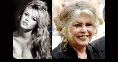 These Celebrities Did Not Age Well At All