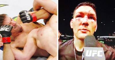 Chris Weidman Gets Destroyed With Brutal Elbows During UFC 194 Title Match