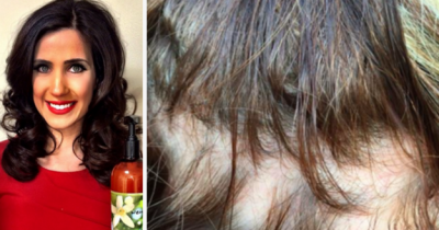 Women Are Speaking Out After They Say A Popular Hair Product Is Making Them Go Bald