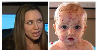 Stranger Calls CPS On Parent For Chickenpox Party