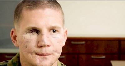 5 Years Ago, A Young Veteran Threw Himself On A Grenade To Save A Friend. This Is Him Today