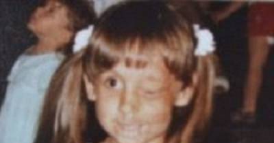 Girl With Facial Tumor Who Was Bullied Finally Finds Her True Love