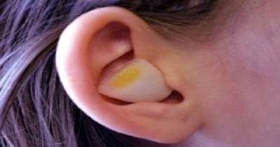 This Is What Happen When You Put Cut Up Onion Inside Your Ear - "Onion" The Amazing &prime;Cure-All&prime;..