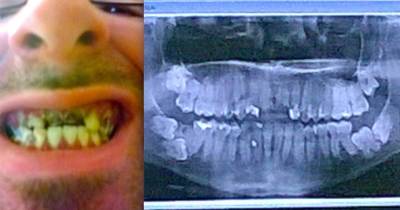 His Teeth Hurt So Badly He Wanted To Die, Then Something Crazy Happened