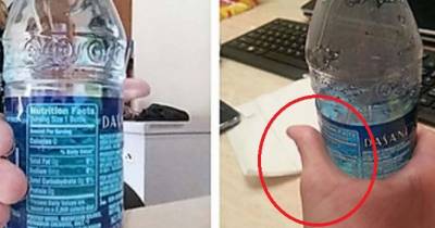 I'm Pretty Sure That Thumbs Aren't Supposed To Work Like That...Ouch