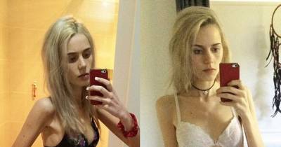 She Was Bullied Because She Had Some Baby Fat, What She Did Next To Herself is Awful