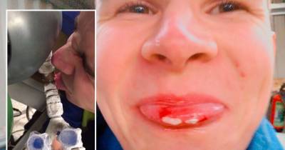 Idiot Welder Rips His Tongue After Mate Dares Him To Lick Frozen Pipe
