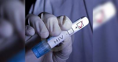 Top 5 Signs You May Have HIV