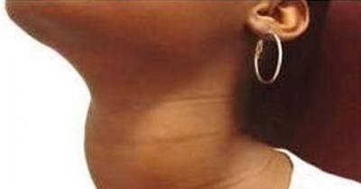 This Lady Is Tired Every Day, Regardless Of How Much She Sleeps. The Reason Is Stuck In Her Throat.