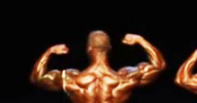 Body Builders Shoulder Starts Leaking Puss On Stage