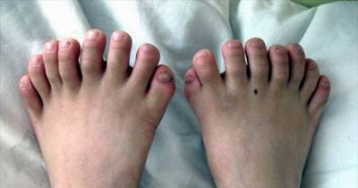 10 Of The World&rsquo;s Craziest Medical Conditions
