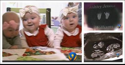 Two Different Moms Deliver Babies, Then Doctors Realize A STUNNING Similarity Between Them...