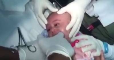 Infant's Throat Is Blocked By Something Scary Until These Doctors Come To The Rescue