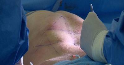 Lad Travels Across Europe To Have Permanent Six Pack Surgery